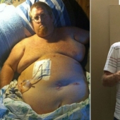 The American thought that being overweight would kill him, recorded a suicide video, and then took and lost 160 kg