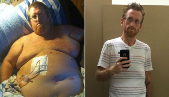 The American thought that being overweight would kill him, recorded a suicide video, and then took and lost 160 kg