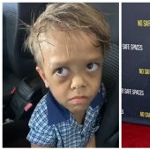 The big heart of a little man: an American comedian raised $ 200,000 to help a dwarf boy