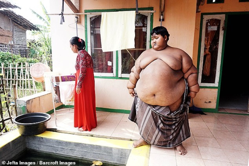 The fattest boy in the world, who weighed 192 kg at the age of 10, lost more than twice as much weight
