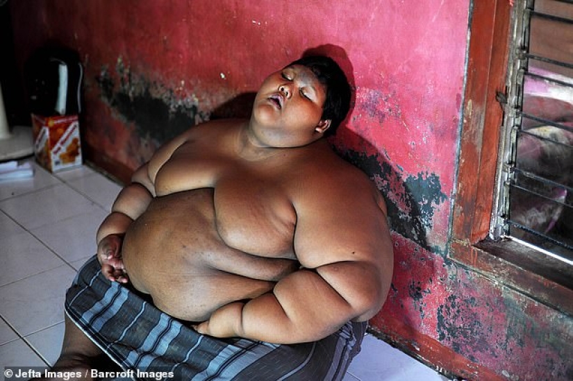 The fattest boy in the world, who weighed 192 kg at the age of 10, lost more than twice as much weight