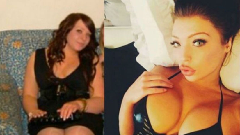 The girl who was teased for being overweight, had plastic surgery for 34 thousand dollars and can't stop