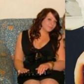 The girl who was teased for being overweight, had plastic surgery for 34 thousand dollars and can't stop