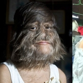 "The most hairy girl in the world" got married and started shaving her face