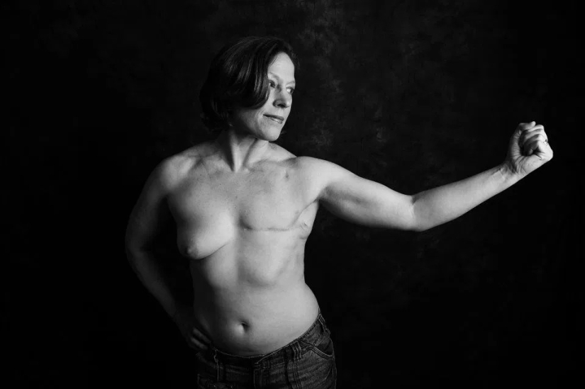 The Naked Truth: Brave patients confront cancer by showing off scars in Ami Barwell's poignant photo project