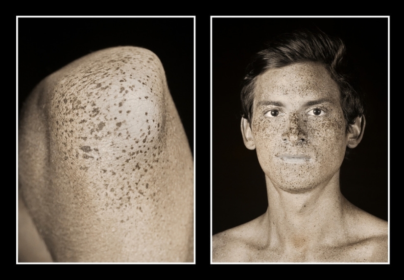 The photographer showed how much the sun changes the skin. After that, you will stop loving the tan!
