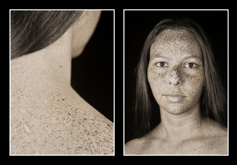 The photographer showed how much the sun changes the skin. After that, you will stop loving the tan!