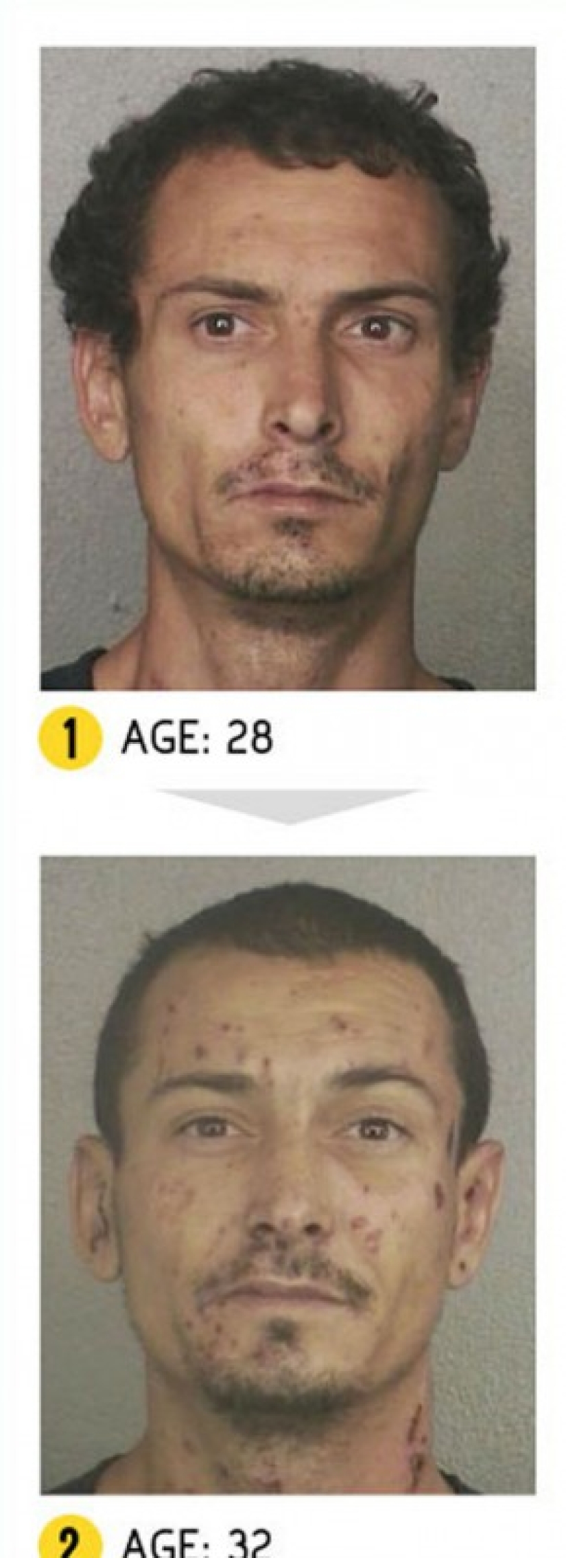 The result is obvious — how a person's appearance changes because of drugs