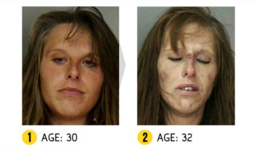 The result is obvious — how a person's appearance changes because of drugs