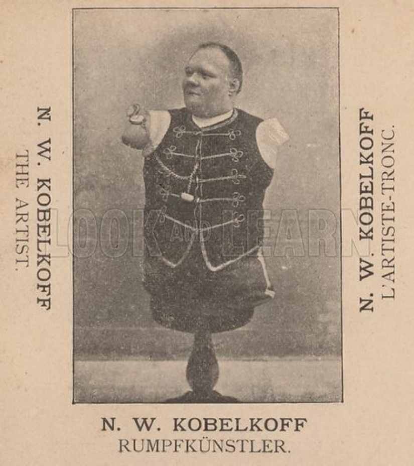 The story of Nikolai Kobelkov, or How a Russian without arms and without legs became an Austrian millionaire