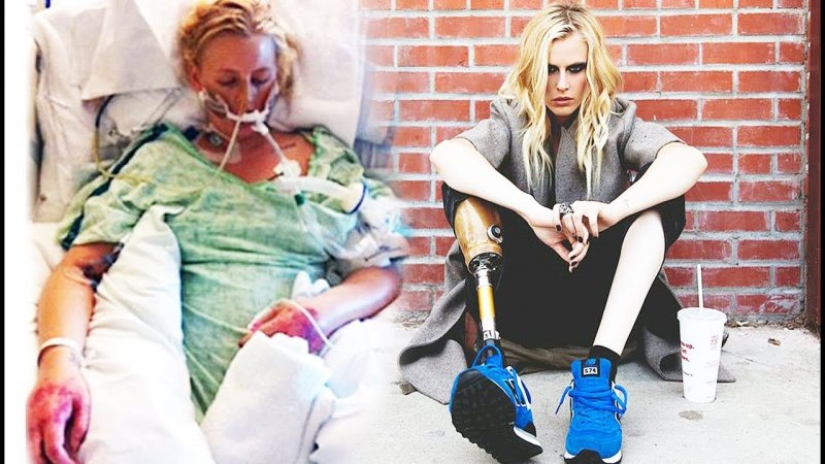 The tragic story of Lauren Wasser, who lost her legs after using tampons