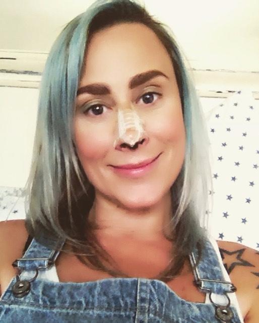 The woman liked retouched selfies so much that she became obsessed with plastic surgery