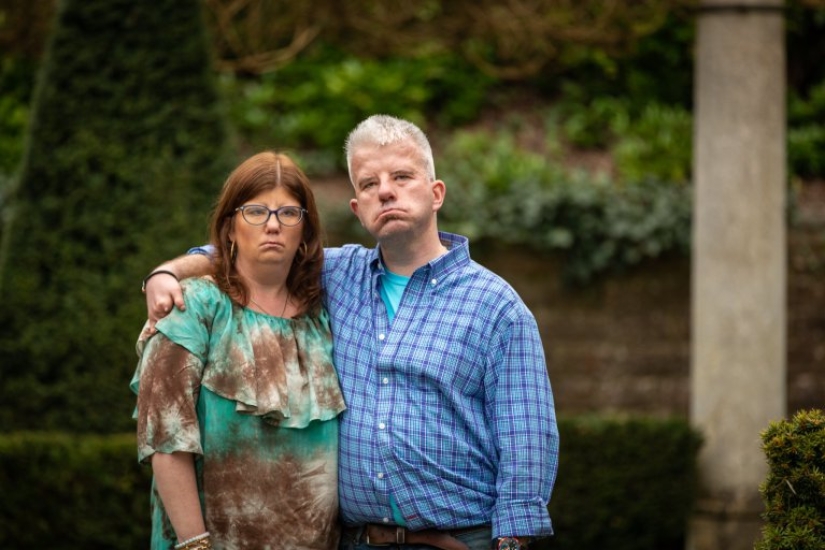 They can't smile, but they know how to love: a man and a woman with a rare facial anomaly decided to get married