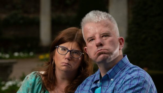 They can't smile, but they know how to love: a man and a woman with a rare facial anomaly decided to get married