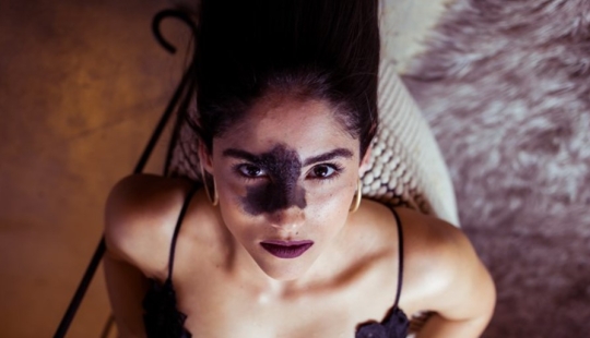 Todos se burlaron de esta chica por su marca de nacimiento, y ella tomó y se convirtió en modelo