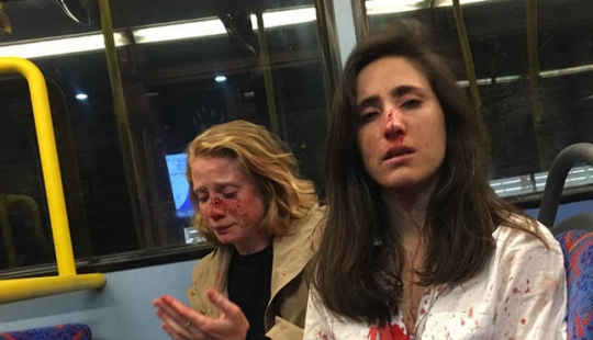 Two lesbians were beaten and robbed on the bus for not wanting to kiss