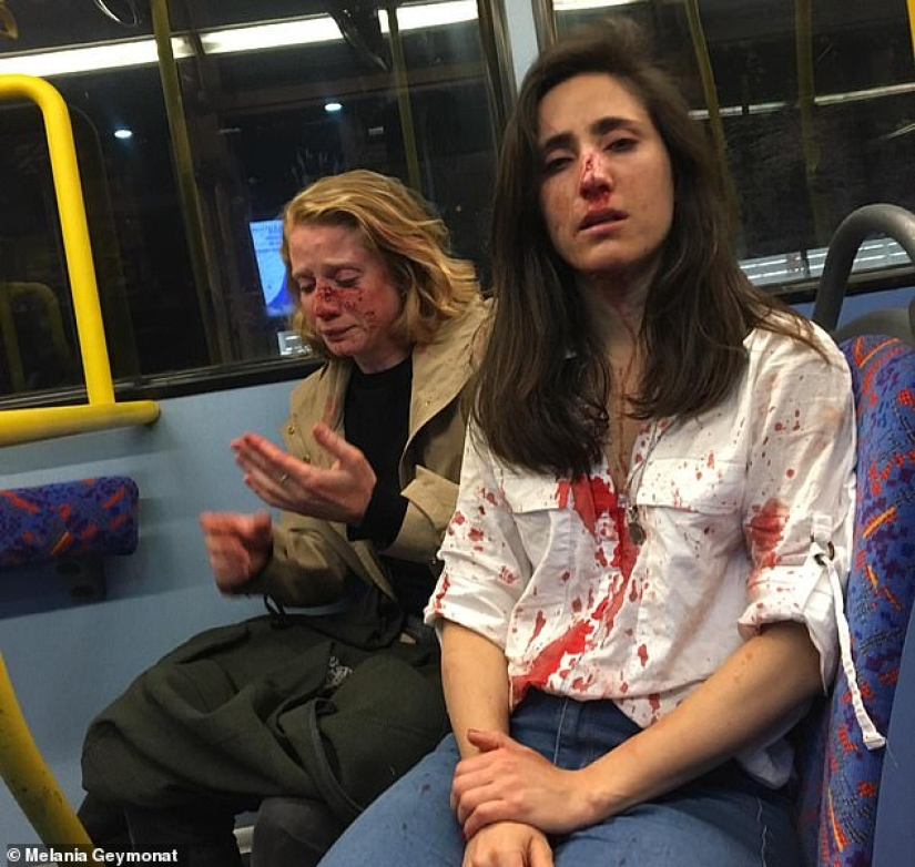 Two lesbians were beaten and robbed on the bus for not wanting to kiss