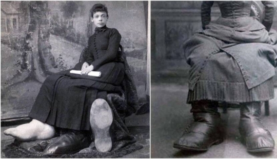 Ugliness eternal seal: the tragic fate of the "girl with big feet from Ohio"