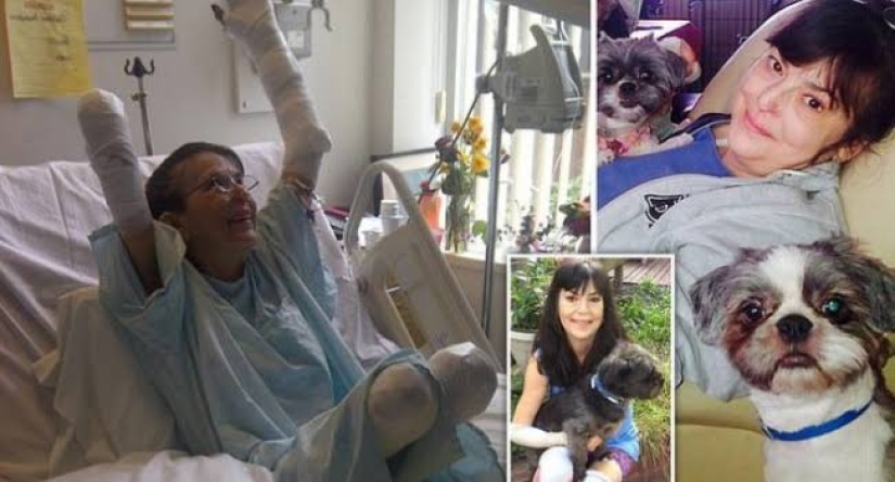Un juego con final triste: una mujer enfermó de sepsis y se sometió a tres amputaciones después de ser mordida por su amado perro