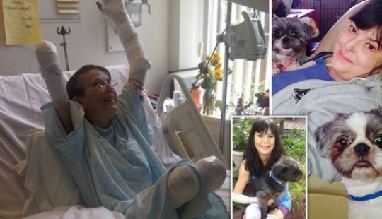 Un juego con final triste: una mujer enfermó de sepsis y se sometió a tres amputaciones después de ser mordida por su amado perro