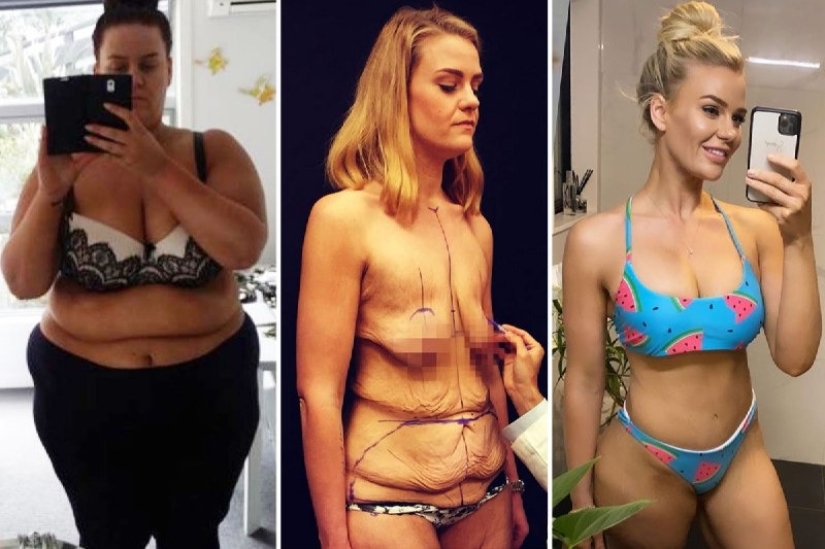 Un nuevo cuerpo es una nueva vida: la niña ha cambiado más allá del reconocimiento, habiendo perdido 90 kg