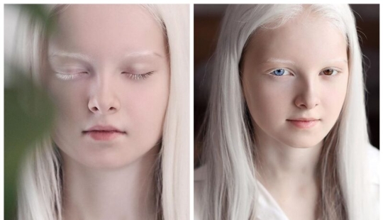 Una niña albina de Chechenia golpeó con su apariencia única