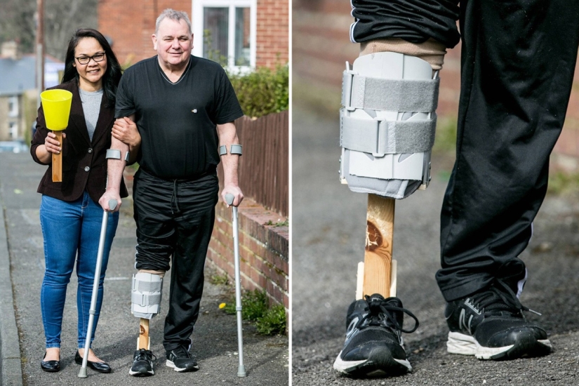 Una pierna nueva con sus propias manos: una mujer hizo una prótesis para su marido con materiales improvisados