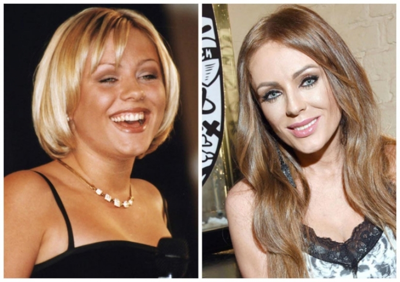 What did the primates of Russian show business look like before they made plastic surgery