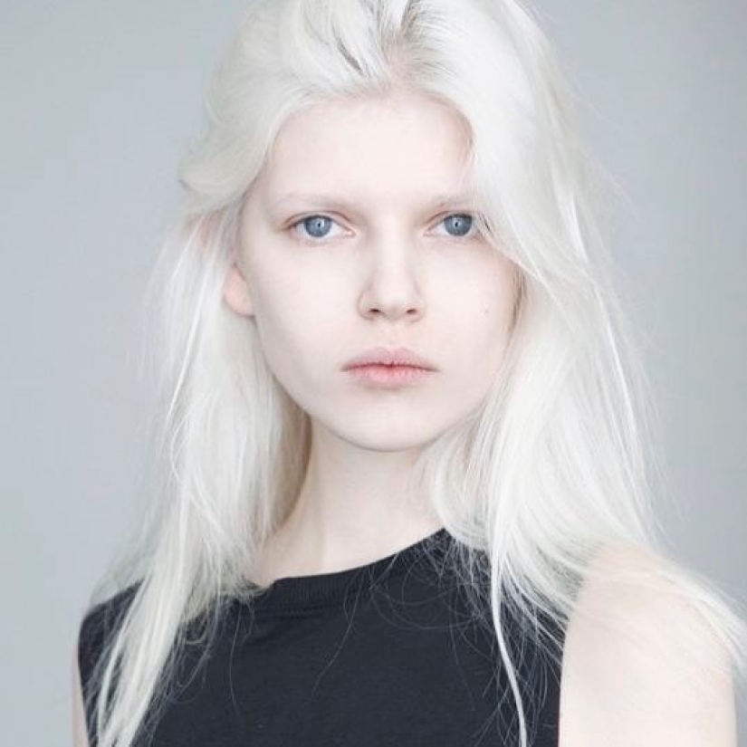 What do albinos of different nationalities and races look like - Pictolic