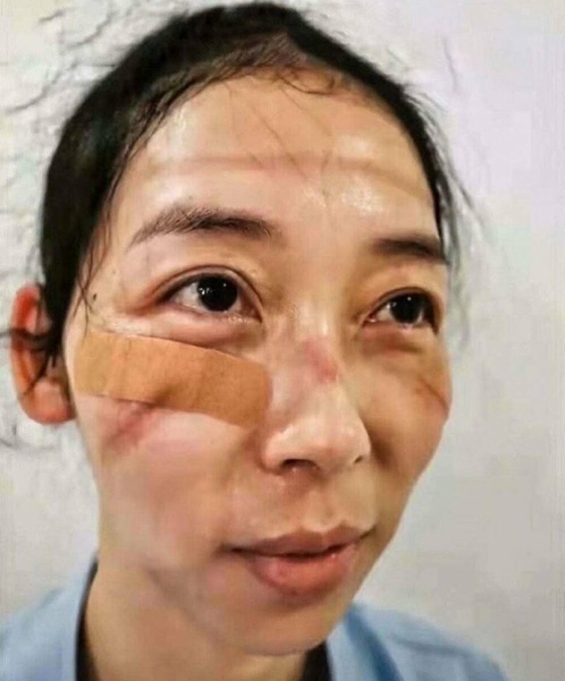 What do the faces of Chinese doctors look like at the end of a work shift