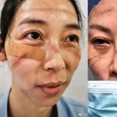 What do the faces of Chinese doctors look like at the end of a work shift