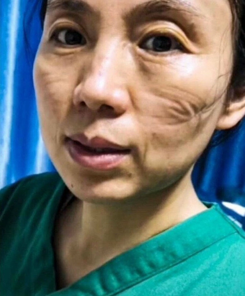 What do the faces of Chinese doctors look like at the end of a work shift