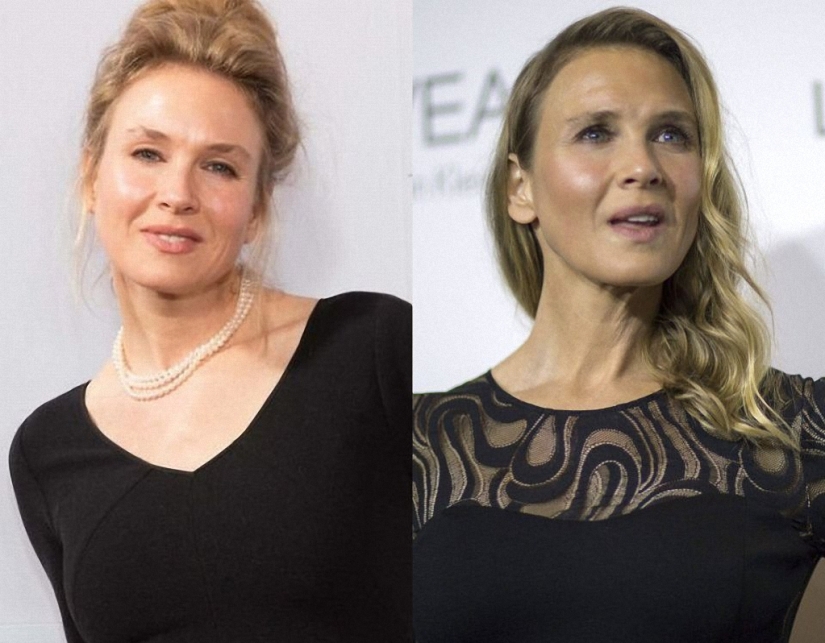 What happened to René Zellweger?