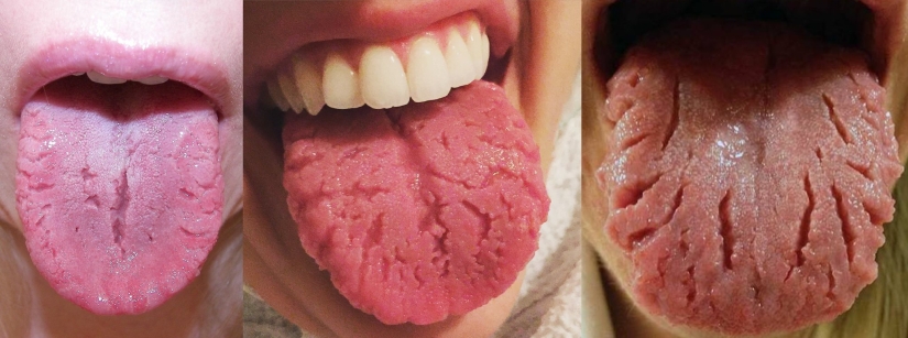 Where are the cracks on the tongue from and how dangerous is it?