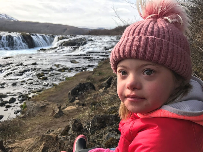 Why there are practically no people with Down syndrome in Iceland
