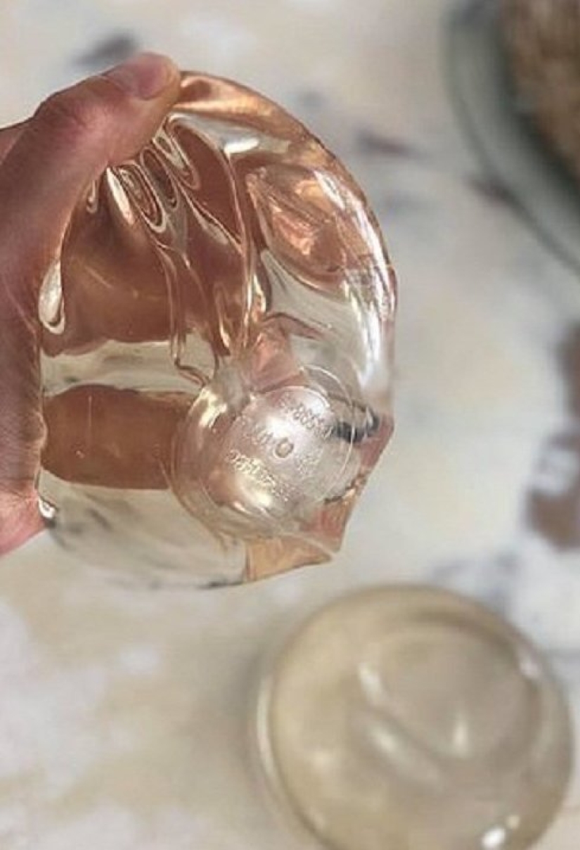 "With them, my life turned into hell": an Australian woman told why she got rid of breast implants