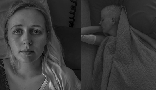 "You'll be fine": photographer captures wife and her battle with cancer