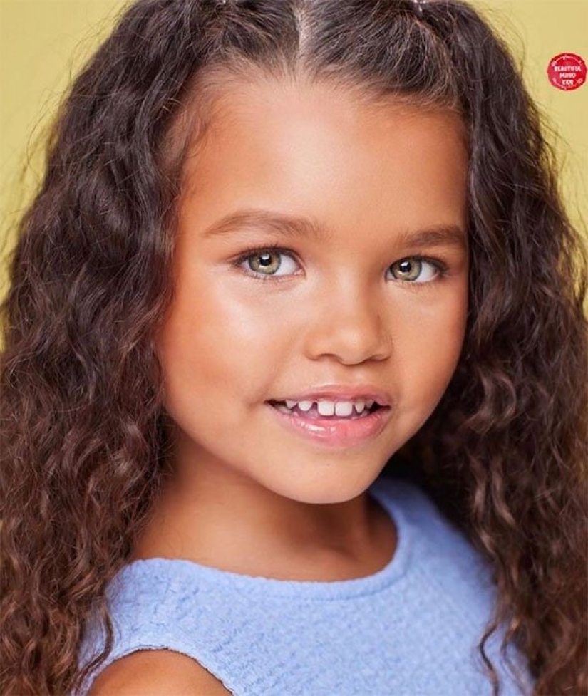 10 children of unique beauty - and all because of an unusual combination of genes