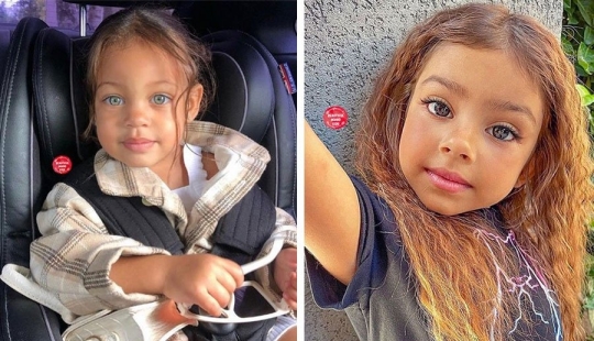 10 children of unique beauty - and all because of an unusual combination of genes