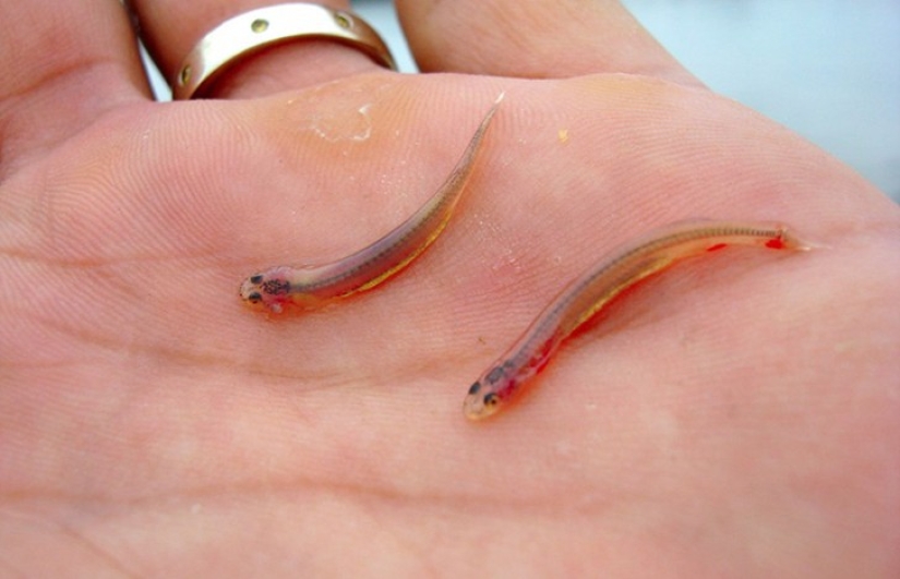 10 of the most dangerous parasites that can live in the human body