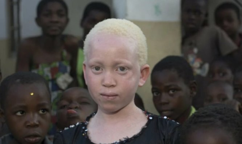 11 years ago, a "white angel" was born to a Nigerian couple. What a beauty the girl has become over the years