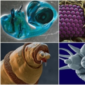 15 amazing creatures that can't be seen without a microscope