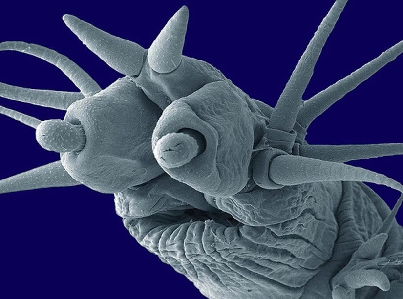 15 amazing creatures that can't be seen without a microscope