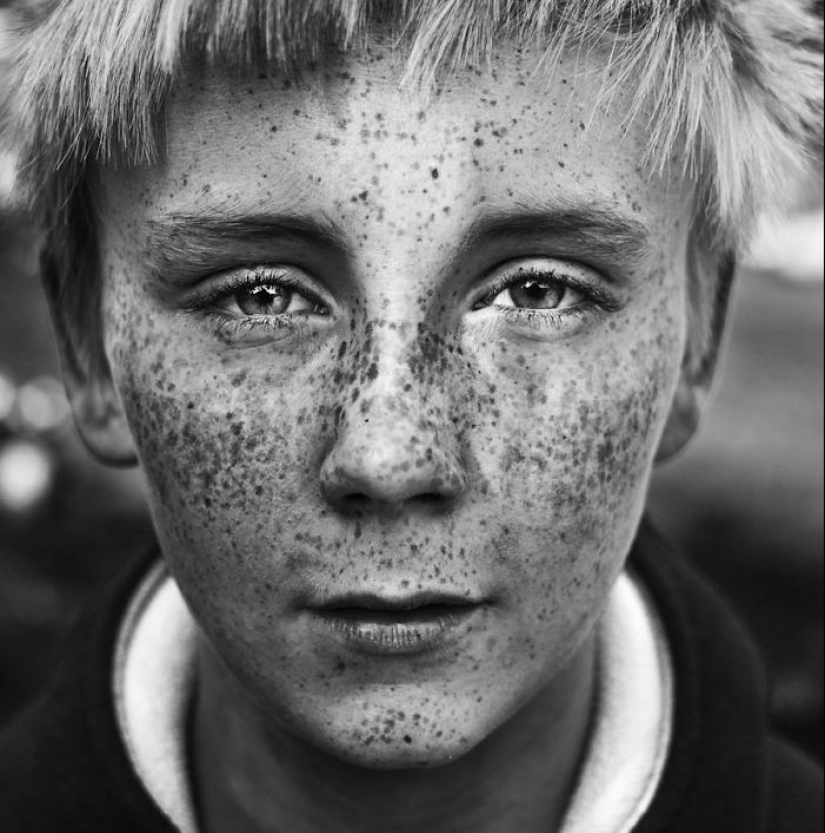 16 Mesmerizing Photos of People with Freckles