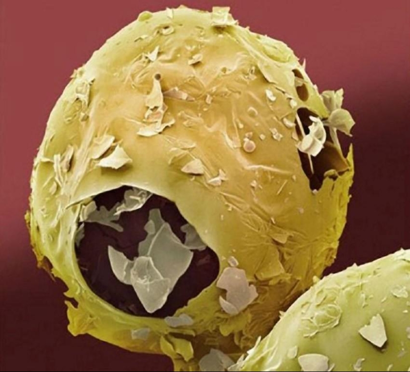 18 amazing food photos under the microscope