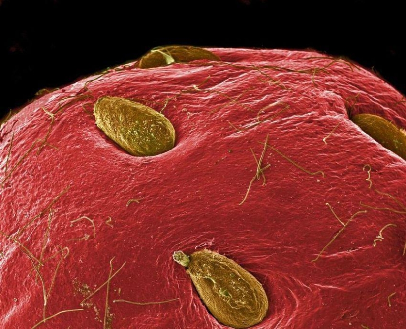18 increíbles fotos de comida bajo el microscopio
