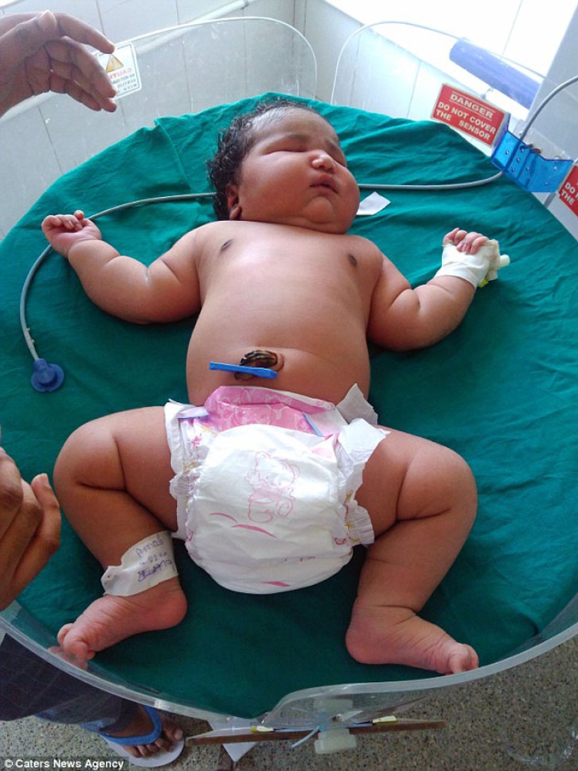 19-year-old mother gave birth to the heaviest girl weighing 6.8 kg