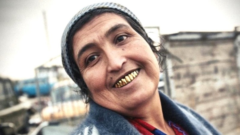 3 Reasons why Gypsies Give themselves Gold Teeth