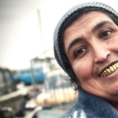 3 Reasons why Gypsies Give themselves Gold Teeth