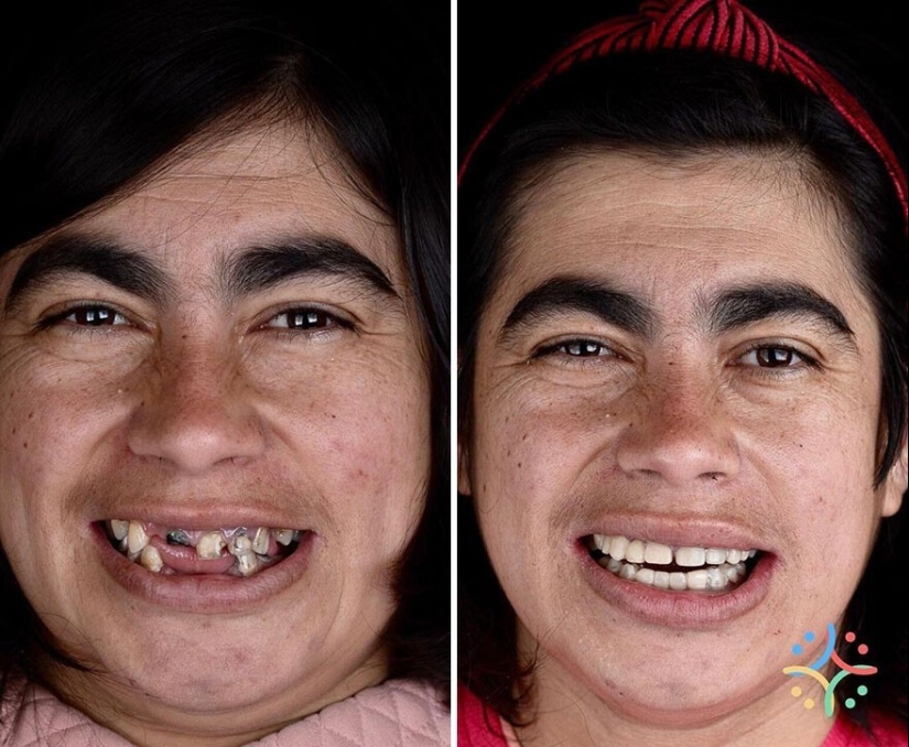 30 fotos antes y después de que la gente recuperara su sonrisa